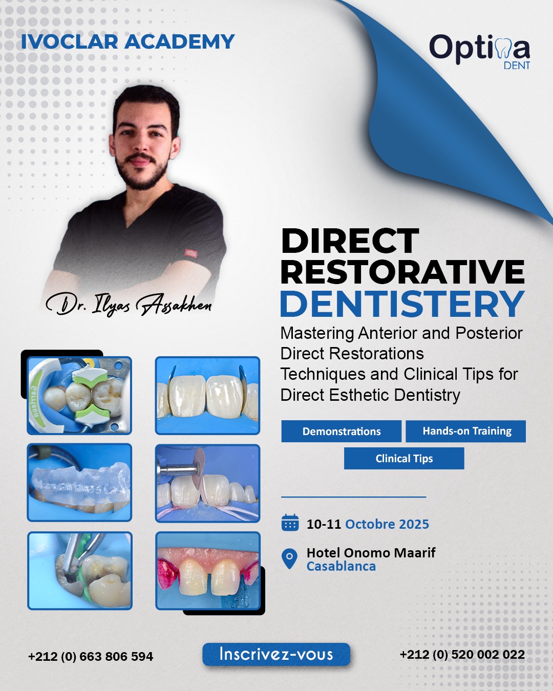 Ivoclar Academy Meeting – Master Class By Dr. Ilyas ASSAKHEN