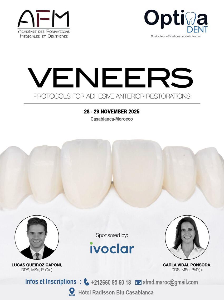Formation exclusive : VENEERS – Protocols for Adhesive Anterior Restorations