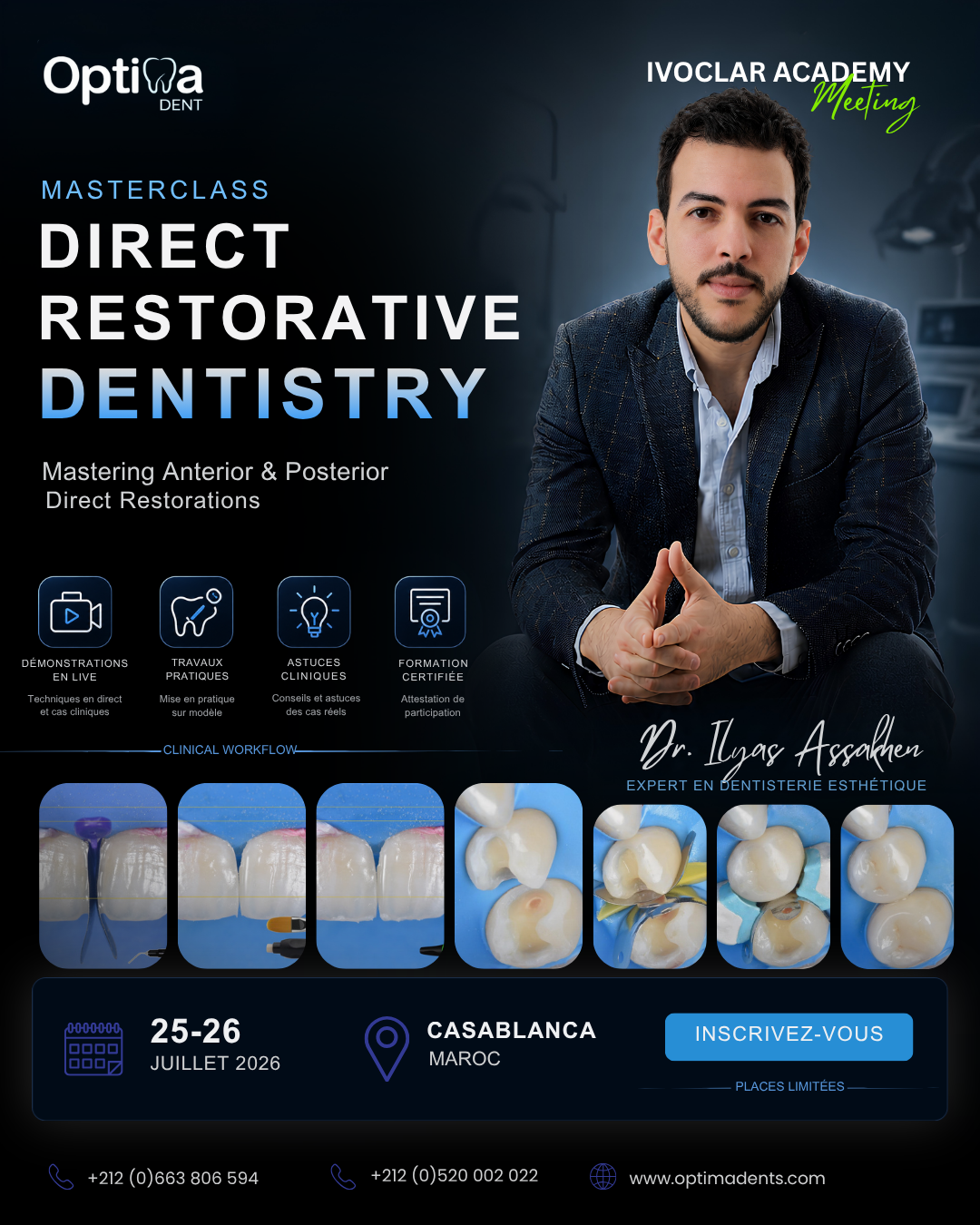 MASTERCLASS – DIRECT RESTORATIVE DENTISTRY